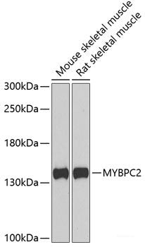 Immunofluorescence analysis of A549 cells using MTF2 Polyclonal Antibody