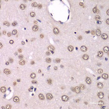 Immunofluorescence analysis of A549 cells using PRKD3 Polyclonal Antibody