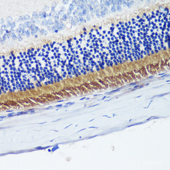 Immunohistochemistry of paraffin-embedded Human colon using LMOD1 Polyclonal Antibody at dilution of 1:200 (40x lens).