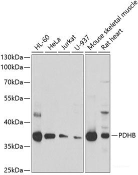 Immunohistochemistry of paraffin-embedded Rat brain using CLIC4 Polyclonal Antibody at dilution of 1:100 (40x lens).