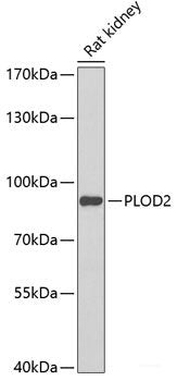 Immunofluorescence analysis of A549 cells using L3MBTL1 Polyclonal Antibody