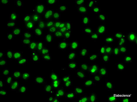 Western blot analysis of extracts of Mouse brain using DNM3 Polyclonal Antibody at dilution of 1:2000.