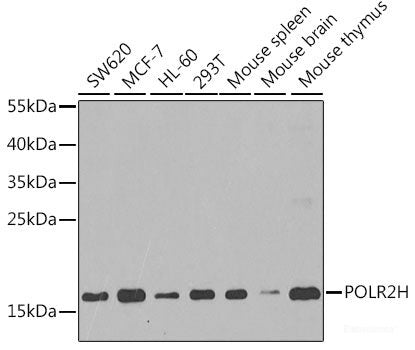 Immunohistochemistry of paraffin-embedded Rat brain using LDLRAP1 Polyclonal Antibody at dilution of 1:100 (40x lens).