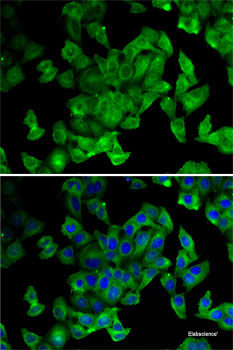 Immunohistochemistry of paraffin-embedded Human lung cancer using TRMT2A Polyclonal Antibody at dilution of 1:100 (40x lens).