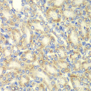 Immunofluorescence analysis of A-549 cells using NTMT1 Polyclonal Antibody