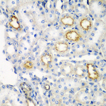 Immunohistochemistry of paraffin-embedded Mouse lung using SERPINA10 Polyclonal Antibody at dilution of 1:100 (40x lens).