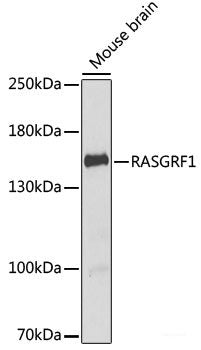 Immunofluorescence analysis of A549 cells using HSPA14 Polyclonal Antibody