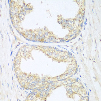 Immunofluorescence analysis of A549 cells using MEPCE Polyclonal Antibody