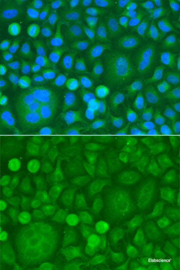 Immunohistochemistry of paraffin-embedded Rat kidney using CCL26 Polyclonal Antibody at dilution of 1:200 (40x lens).