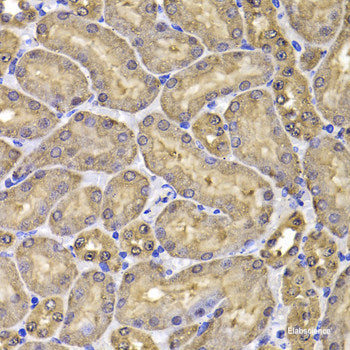 Immunofluorescence analysis of A549 cells using ELF5 Polyclonal Antibody