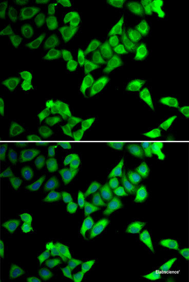 Immunohistochemistry of paraffin-embedded Rat brain using PTPRE Polyclonal Antibody at dilution of 1:100 (40x lens).