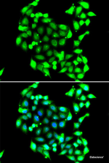 Immunohistochemistry of paraffin-embedded Human liver damage using PEX3 Polyclonal Antibody at dilution of 1:100 (40x lens).