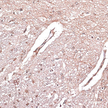 Immunohistochemistry of paraffin-embedded Rat kidney using PIP4K2A Polyclonal Antibody at dilution of 1:100 (40x lens).