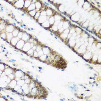 Immunohistochemistry of paraffin-embedded Rat brain using SAR1A Polyclonal Antibody at dilution of 1:100 (40x lens).