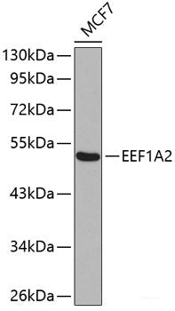Immunofluorescence analysis of A549 cells using SUMO4 Polyclonal Antibody