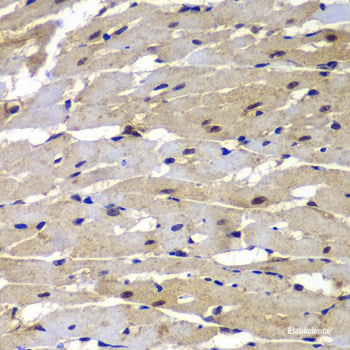Immunohistochemistry of paraffin-embedded Mouse cerebellum using CA8 Polyclonal Antibody at dilution of 1:100 (40x lens).
