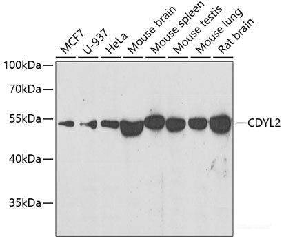 Immunohistochemistry of paraffin-embedded Rat heart using GLUT4 Polyclonal Antibody at dilution of 1:100 (40x lens).