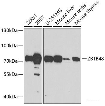 Western blot analysis of extracts of various cell lines using TNFRSF8 Polyclonal Antibody at dilution of 1:1000.