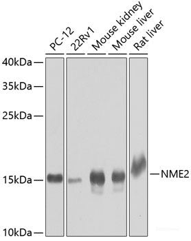 Western blot analysis of extracts of various cell lines using CLPTM1 Polyclonal Antibody at dilution of 1:1000.