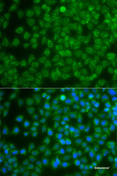 Immunohistochemistry of paraffin-embedded Human stomach using FANCA Polyclonal Antibody at dilution of 1:100 (40x lens).