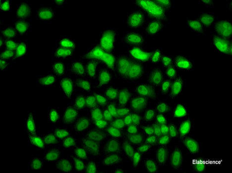 Western blot analysis of extracts of NCI-H460 cells using GTF2A2 Polyclonal Antibody at dilution of 1:1000.