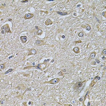 Immunohistochemistry of paraffin-embedded Mouse stomach using UBE2A Polyclonal Antibody