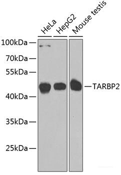 Immunohistochemistry of paraffin-embedded Rat kidney using BSND Polyclonal Antibody at dilution of 1:100 (40x lens).