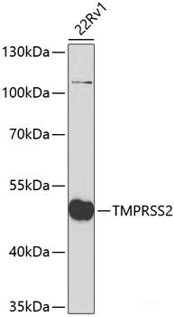 Western blot analysis of extracts of various cell lines using CHEK2 Polyclonal Antibody at dilution of 1:1000.