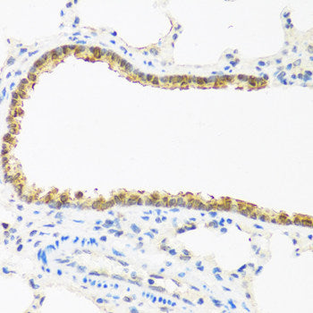 Immunofluorescence analysis of C6 cells using P70 S6K Polyclonal Antibody at dilution of 1:100.C6 cells were treated by Serum-starvation overnight at 37℃. Blue: DAPI for nuclear staining.