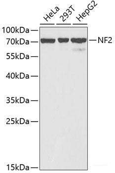 Western blot analysis of extracts of Human fetal intestine using GRB14 Polyclonal Antibody.