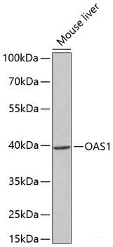Immunohistochemistry of paraffin-embedded Mouse brain using MIP Polyclonal Antibody at dilution of 1:100 (40x lens).