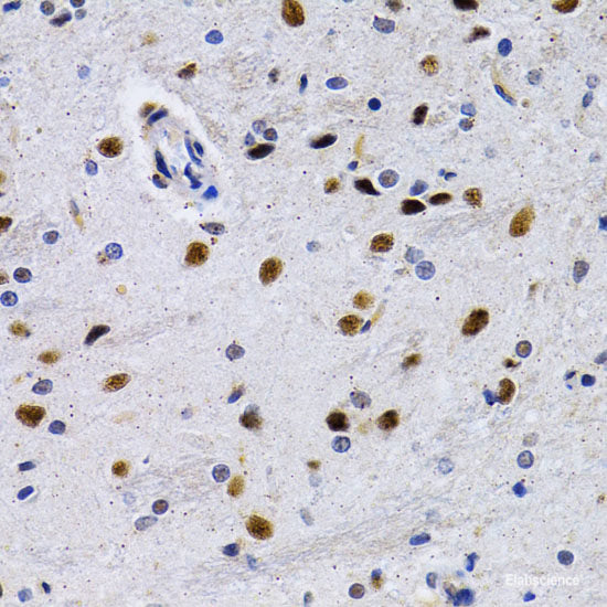 Immunofluorescence analysis of A549 cells using WHSC1L1 Polyclonal Antibody