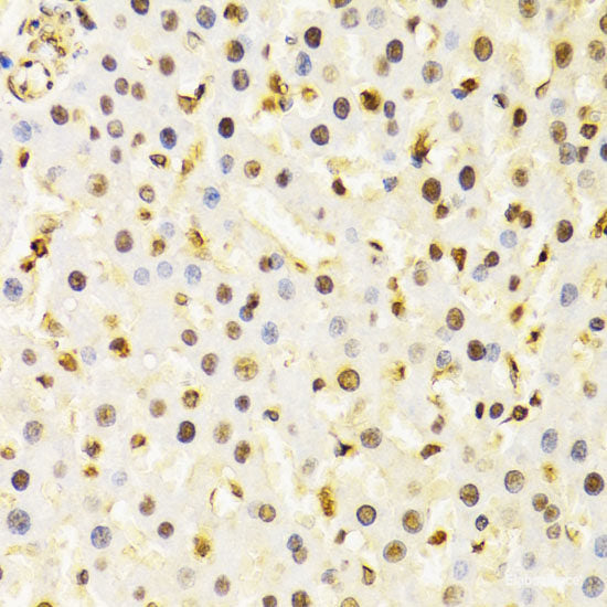 Immunofluorescence analysis of HeLa cells using RAB6A Polyclonal Antibody