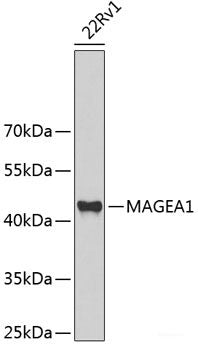 Immunohistochemistry of paraffin-embedded Mouse kidney using BNIP3 Polyclonal Antibody at dilution of 1:100 (40x lens).