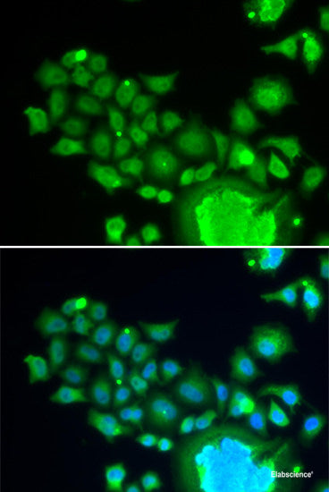 Immunofluorescence analysis of U2OS cells using TAB1 Polyclonal Antibody