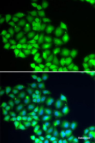 Western blot analysis of extracts of various cell lines using PDYN Polyclonal Antibody at dilution of 1:1000.