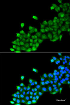 Western blot analysis of extracts of H460 cells using ATM Polyclonal Antibody at dilution of 1:1000.