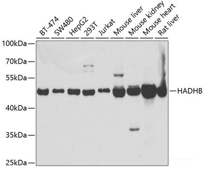 Immunofluorescence analysis of NIH-3T3 cells using ETF1 Polyclonal Antibody at dilution of 1:100 (40x lens). Blue: DAPI for nuclear staining.