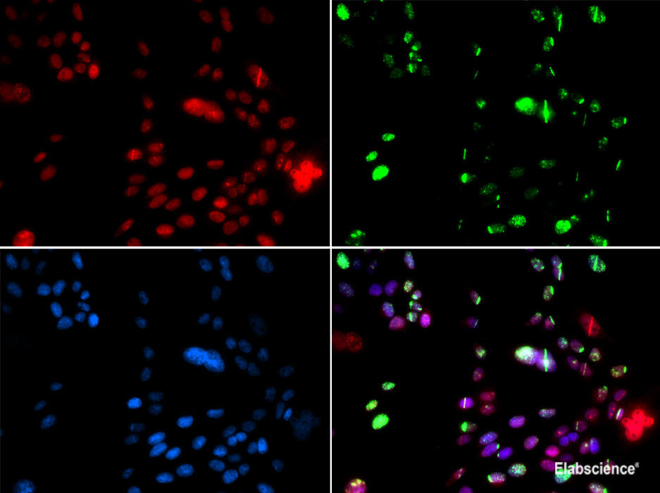 Immunohistochemistry of paraffin-embedded Human esophagus using Polyclonal AntibodyPC4 Polyclonal Antibody at dilution of 1:100 (40x lens).