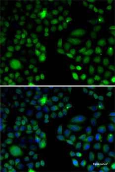 Immunohistochemistry of paraffin-embedded Mouse brain using PUM1 Polyclonal Antibody at dilution of 1:100 (40x lens).