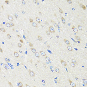 Western blot analysis of extracts of Mouse bone marrow using C1R Polyclonal Antibody at dilution of 1:1000.