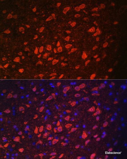 Immunofluorescence analysis of HeLa cells using GRP Polyclonal Antibody at dilution of 1:100. Blue: DAPI for nuclear staining.