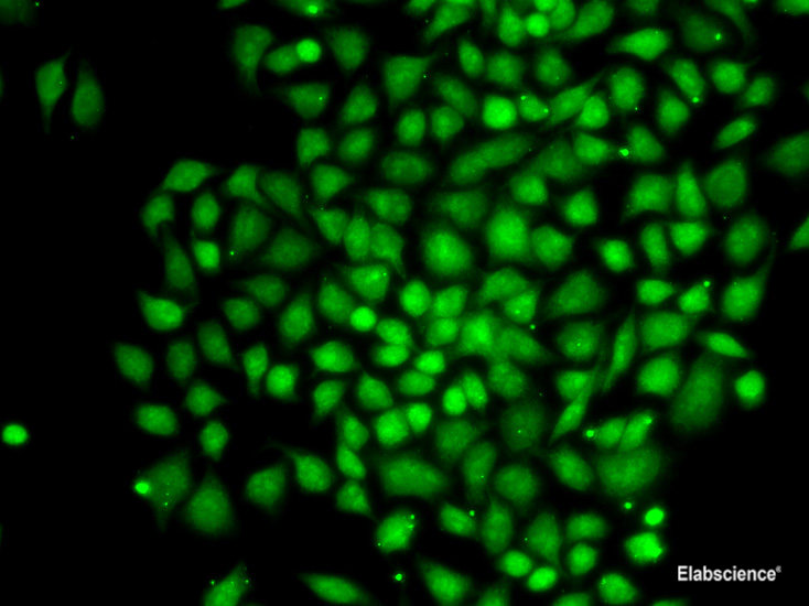 Immunohistochemistry of paraffin-embedded Human liver damage using MGAT1 Polyclonal Antibody at dilution of 1:100 (40x lens).