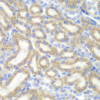 Immunohistochemistry of paraffin-embedded Human stomach using MLN Polyclonal Antibody at dilution of 1:100 (40x lens).