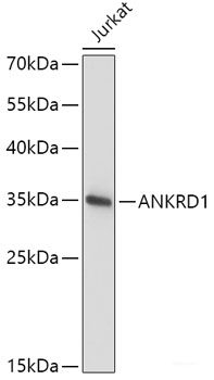 Western blot analysis of extracts of various cell lines using RBP3 Polyclonal Antibody at dilution of 1:1000.