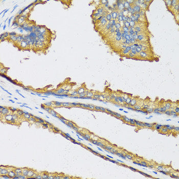 Immunohistochemistry of paraffin-embedded Human esophagus using TRIM27 Polyclonal Antibody at dilution of 1:100 (40x lens).