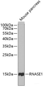 Immunofluorescence analysis of L929 cells using RPL11 Polyclonal Antibody at dilution of 1:100. Blue: DAPI for nuclear staining.