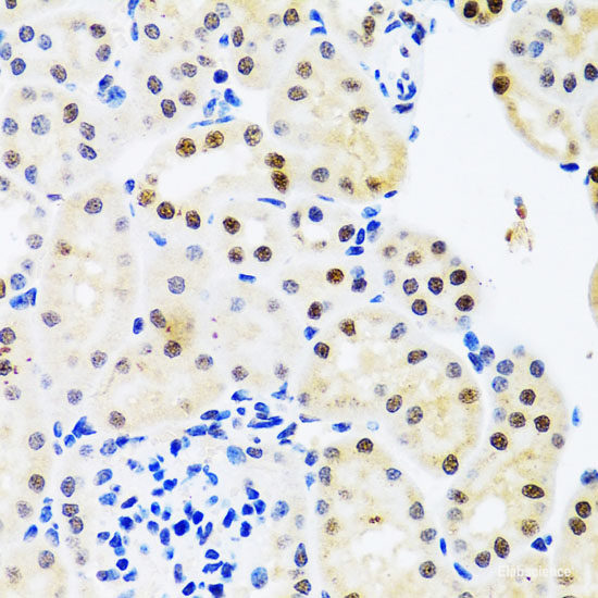 Immunohistochemistry of paraffin-embedded Rat liver using SNRPA Polyclonal Antibody at dilution of 1:100 (40x lens).