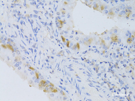 Immunofluorescence analysis of MCF7 cells using KLF10 Polyclonal Antibody