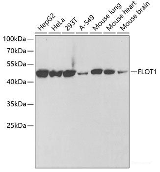 Western blot analysis of extracts of various cell lines using TIMP4 Polyclonal Antibody at dilution of 1:1000.